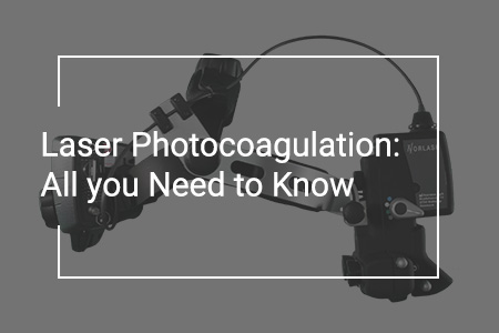 Laser Photocoagulation: Concept, Procedure and Efficiency of Green Laser for Eye Conditions