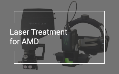 Laser Treatment for Age-Related Macular Degeneration (AMD)