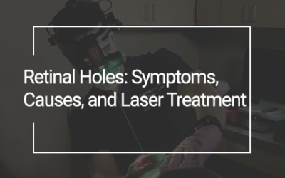Retinal Holes: Symptoms, Causes, and Treatment, Including Laser Treatment