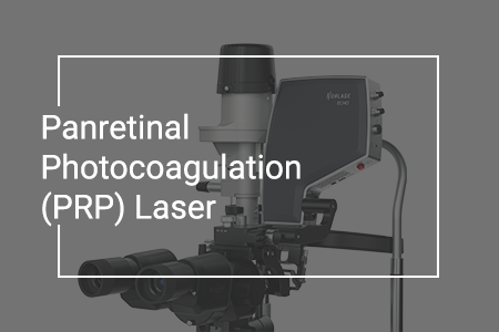 Panretinal Photocoagulation (PRP) Laser: What Is It, Guidelines, and Side Effects